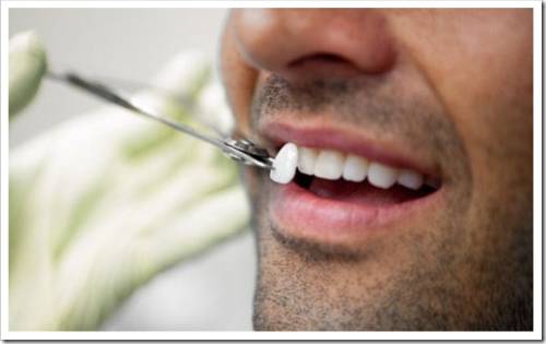 Как осуществляется художественная реставрация зубов?