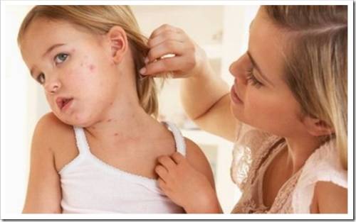 Наиболее распространённые кожные заболевания среди детей 