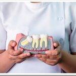 Сложное удаление зуба — что это и как проводится