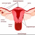 Все о гинекологических заболеваниях: список проблем, которые помогут решить специалисты