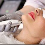 Пикосекундное лазерное омоложение лица — что это за процедура Пикосекундное лазерное омоложение лица — что это за процедура