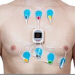 Суточный Монитор ЭКГ: Надежная Диагностика Сердечных Нарушений Суточный Монитор ЭКГ: Надежная Диагностика Сердечных Нарушений