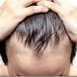 Питьевой коллаген и сезонное выпадение волос: что нужно знать перед началом курса